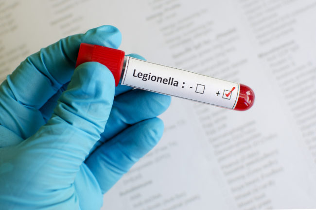 Legionella positive